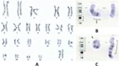 Chromsomal banding analysis